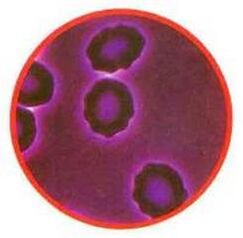 Stress des globules rouges