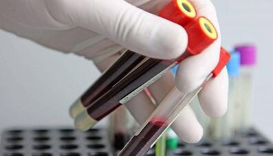 Comment passer des tests pour les parasites dans le corps