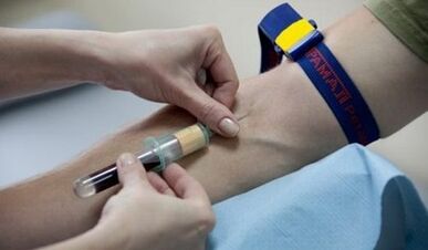 Comment se préparer au test des parasites