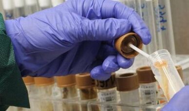 la nécessité de passer l'analyse des parasites