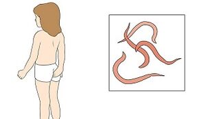 symptômes de la présence de parasites dans le corps humain