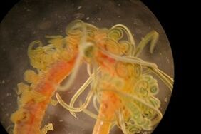 parasites némateux dans le corps humain